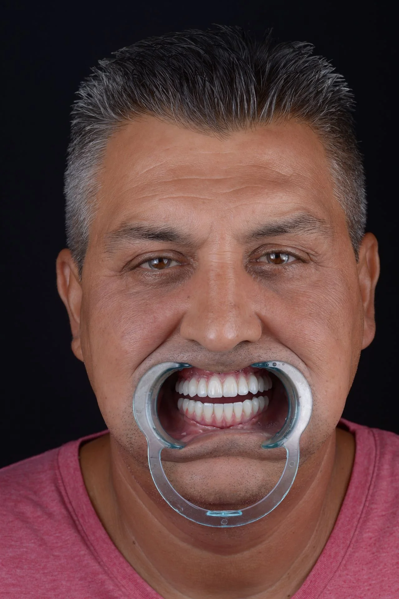 Ergebnis
